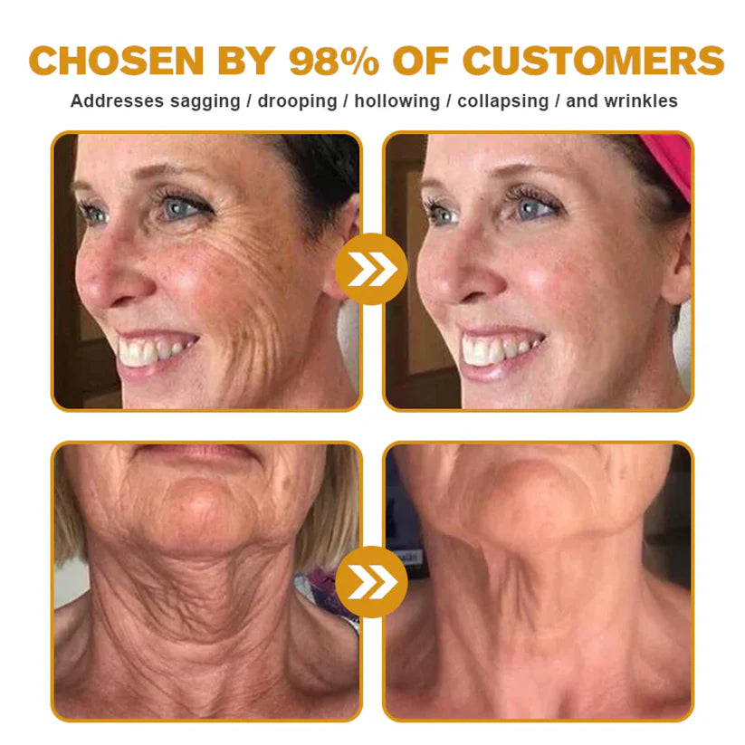 Bee venom Pro Comprehensive Cream