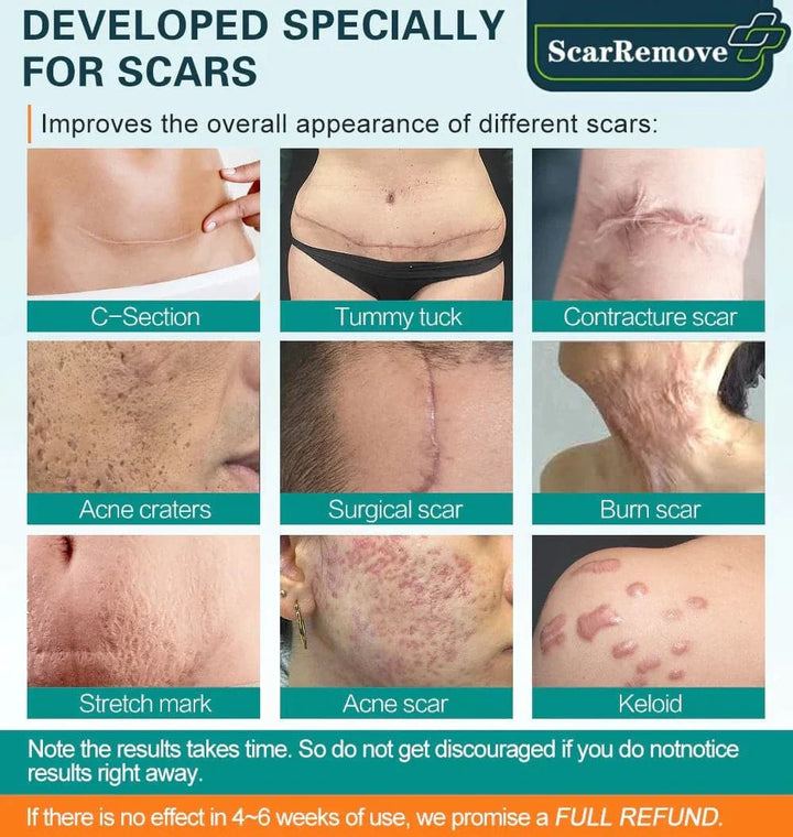 Scar Smells ScarRemove™ Advanced Scar Spray For All Types of Scars – DEANITY