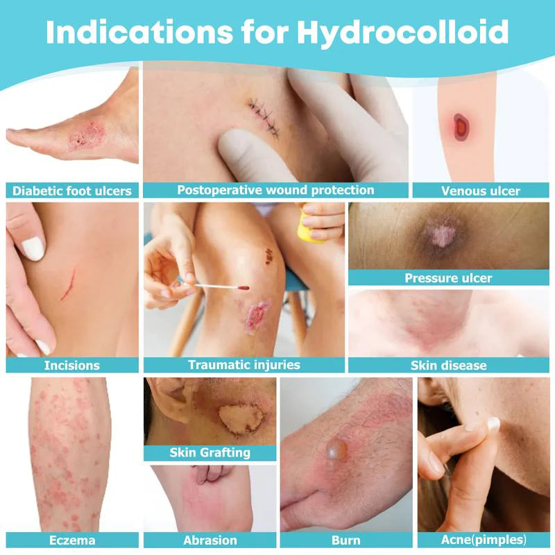 Hydrocolloid Roll
