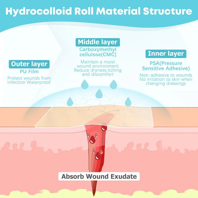 Hydrocolloid Roll