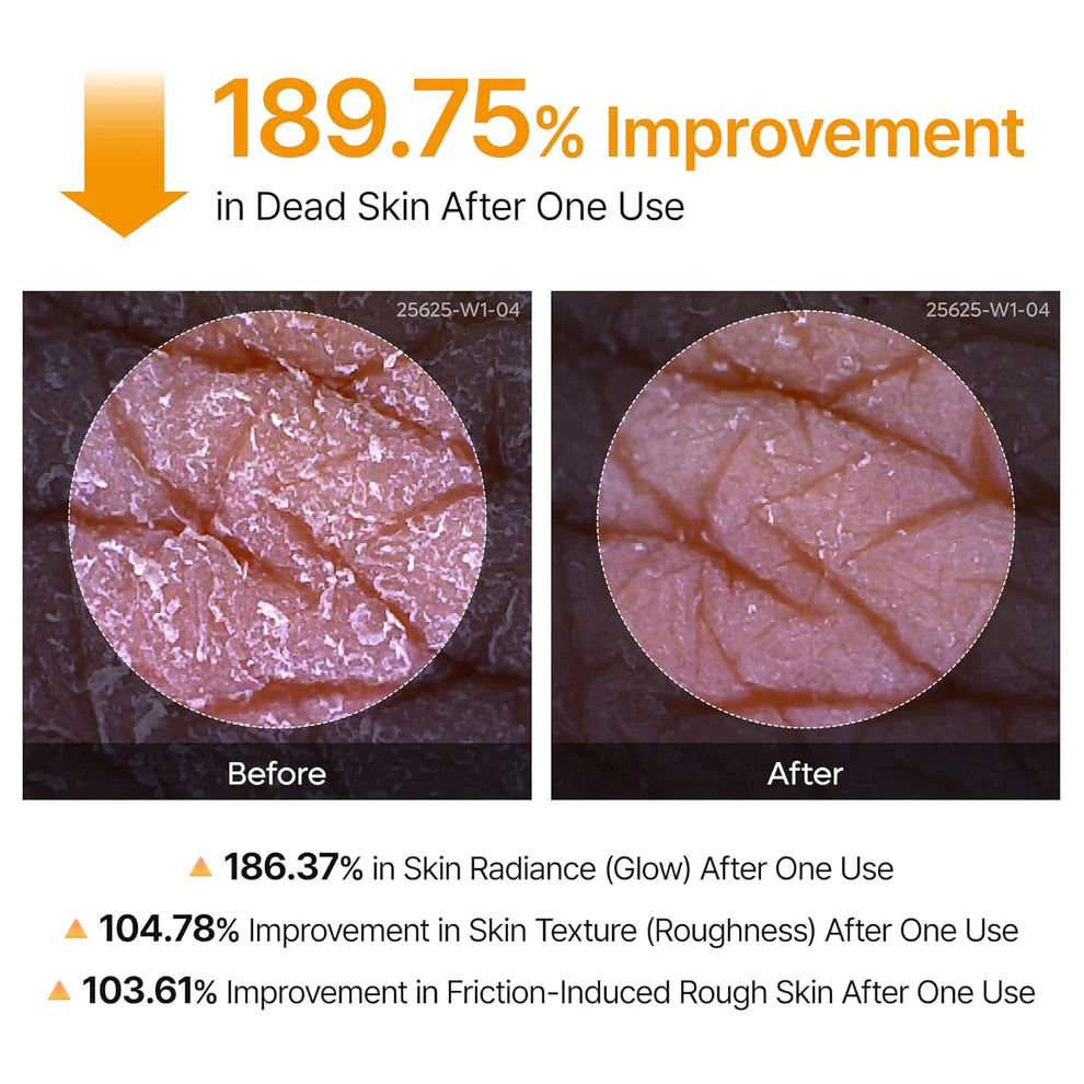 Body Peel Shot Spray