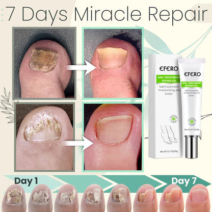 Flyles™Nail Repair Treatment Gel