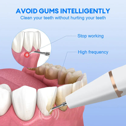 Electric Teeth Cleaner